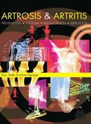 Artrosis y artritis