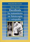 Escoliosis: Tratamiento, fisioterapia y ortopedia